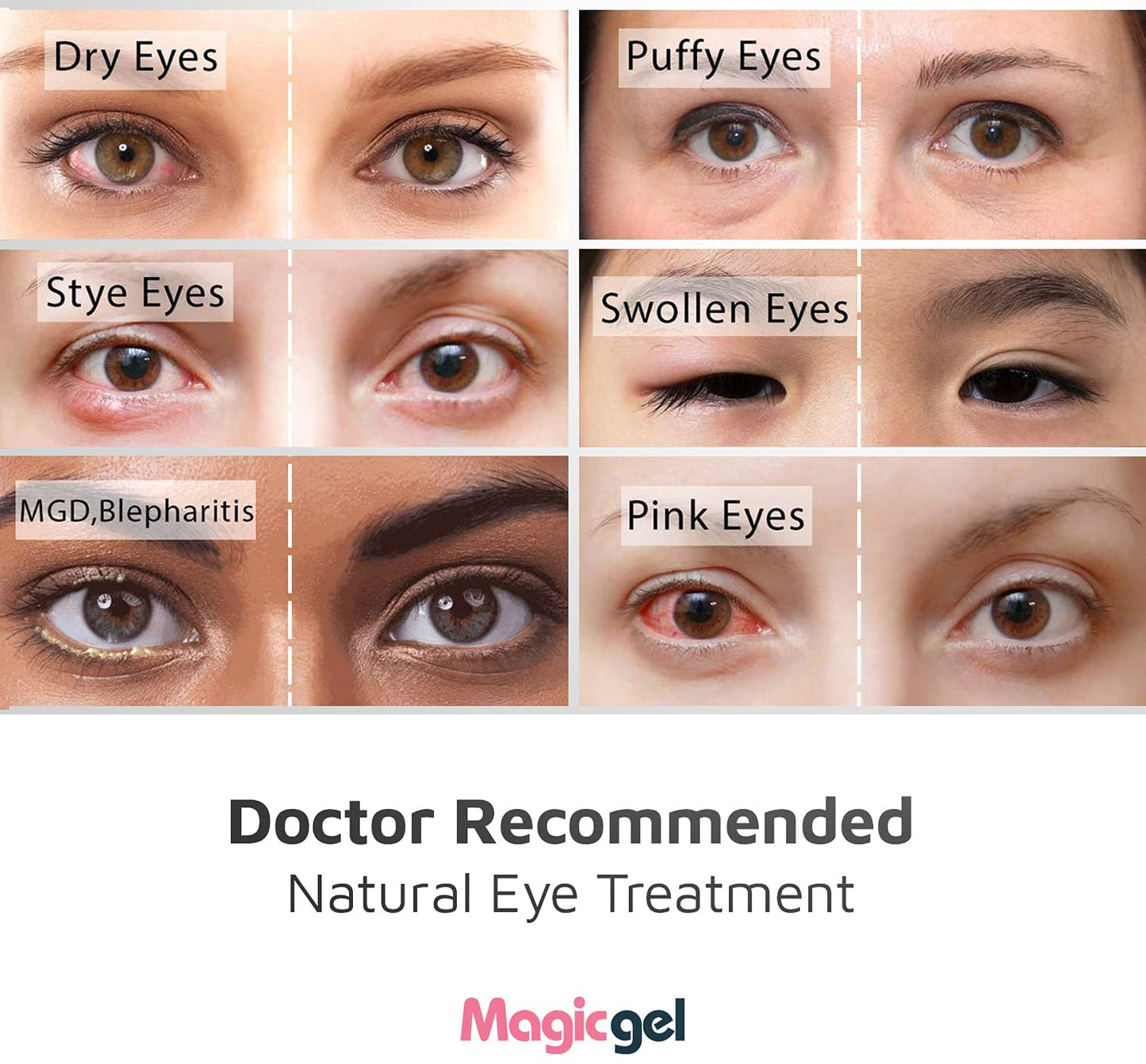 Luxury Eye Mask for Soothing Tired Eyes, Blepharitis, MGD and more (Hot or Cold)