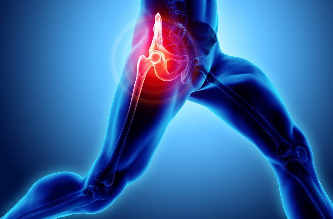 How to use ice packs to relieve discomfort, reduce swelling and ease tight muscles when you have sciatica pain