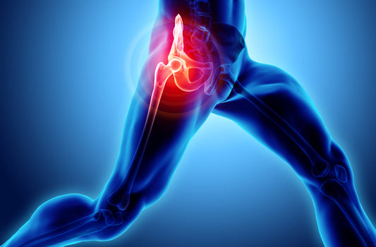 How to use ice packs to relieve discomfort, reduce swelling and ease tight muscles when you have sciatica pain
